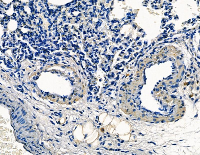 TPX2 Antibody in Immunohistochemistry (Paraffin) (IHC (P))