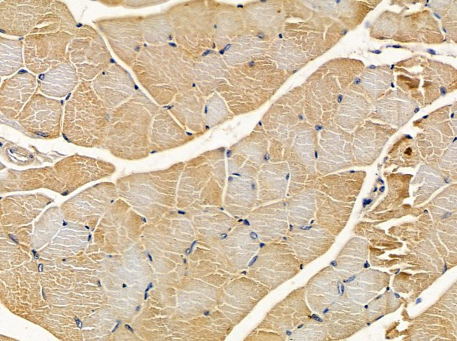 DOK5 Antibody in Immunohistochemistry (Paraffin) (IHC (P))