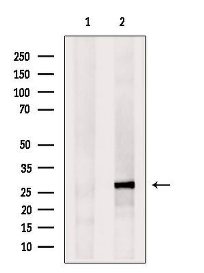 eIF4E3 Antibody in Western Blot (WB)