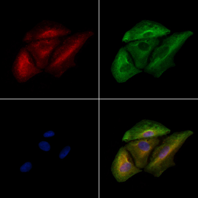 GIT1 Antibody in Immunocytochemistry (ICC/IF)