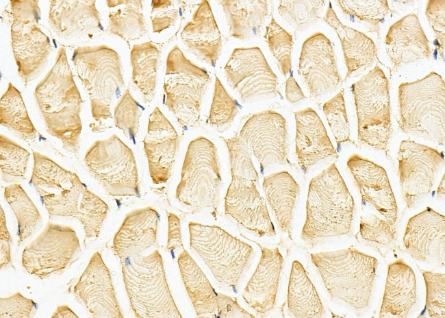 P2Y14 Antibody in Immunohistochemistry (Paraffin) (IHC (P))