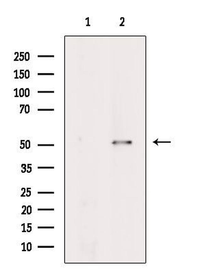 NARF Antibody in Western Blot (WB)