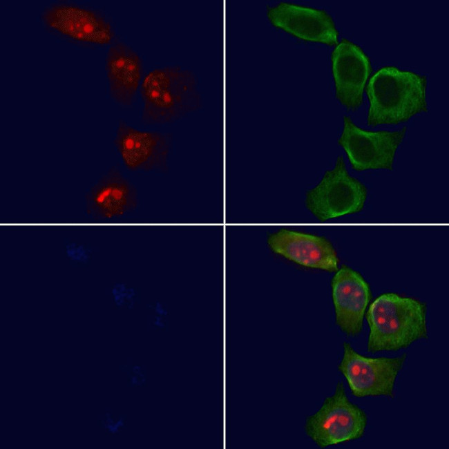 NF1 Antibody in Immunocytochemistry (ICC/IF)