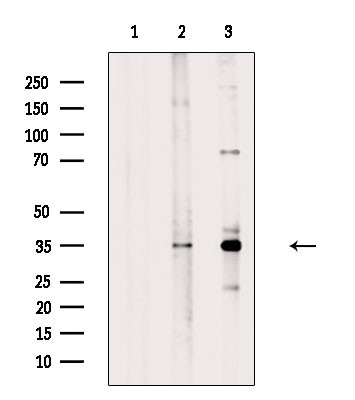 OR1D4/OR1D5 Antibody in Western Blot (WB)