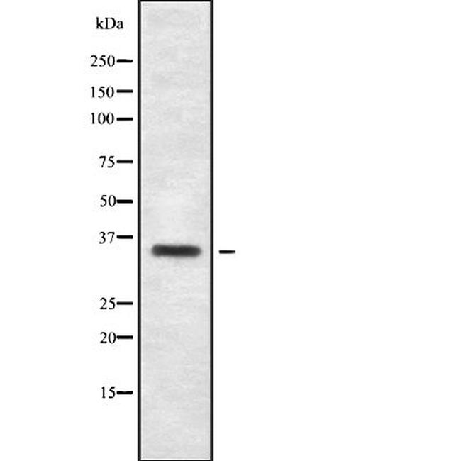 OR2T3/OR2T34 Antibody in Western Blot (WB)