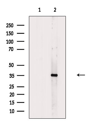 OR2T5/OR2T29 Antibody in Western Blot (WB)