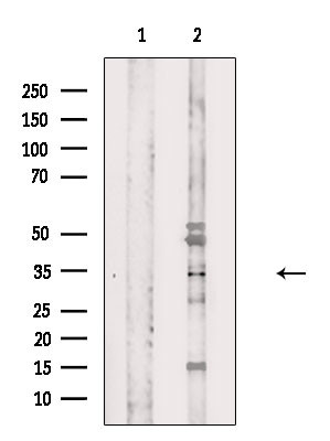 OR3A2/OR3A3 Antibody in Western Blot (WB)