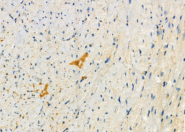 PIKFYVE Antibody in Immunohistochemistry (Paraffin) (IHC (P))