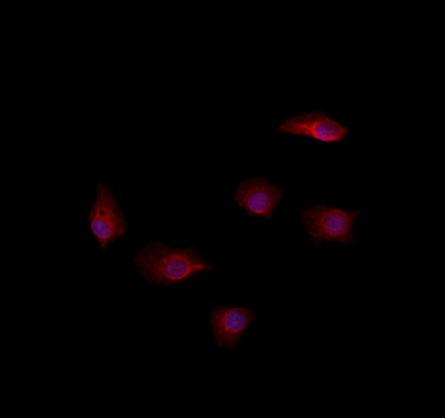 RAB35 Antibody in Immunocytochemistry (ICC/IF)