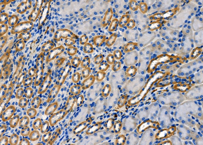 RAB35 Antibody in Immunohistochemistry (Paraffin) (IHC (P))