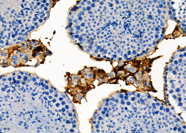 RAB35 Antibody in Immunohistochemistry (Paraffin) (IHC (P))