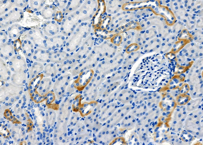 RAB35 Antibody in Immunohistochemistry (Paraffin) (IHC (P))