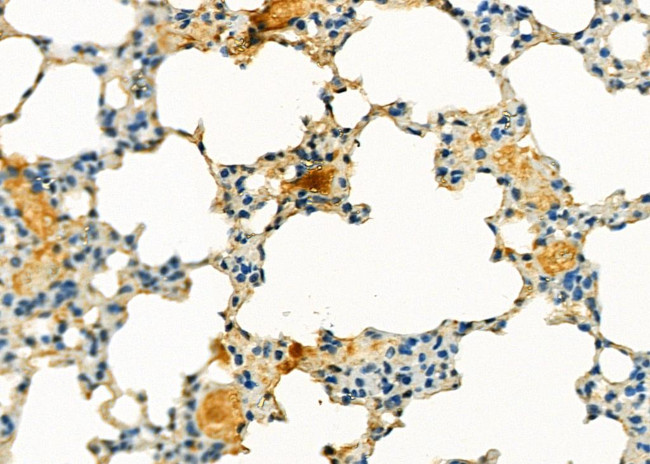 Slc30A8 Antibody in Immunohistochemistry (Paraffin) (IHC (P))