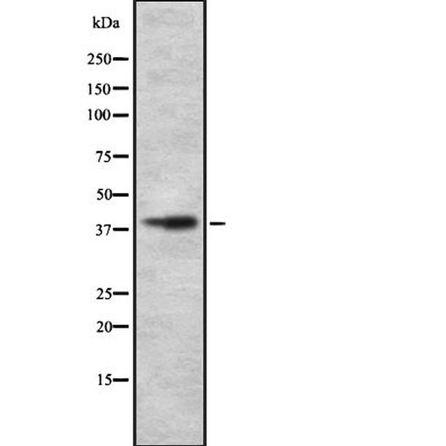 Slc30A8 Antibody in Western Blot (WB)