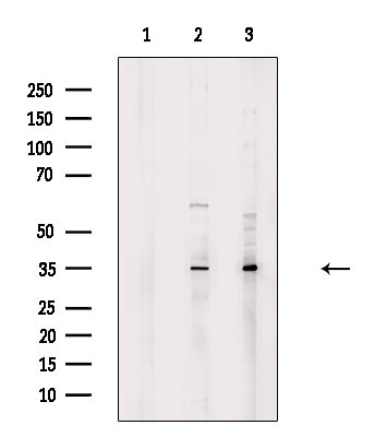 TAS2R43 Antibody in Western Blot (WB)