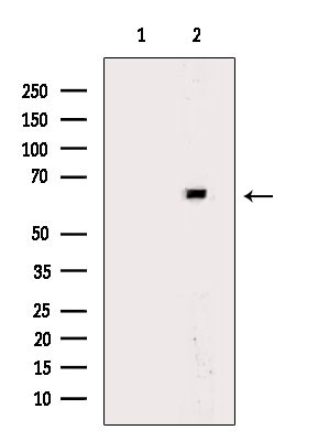 TBX15/TBX18 Antibody in Western Blot (WB)