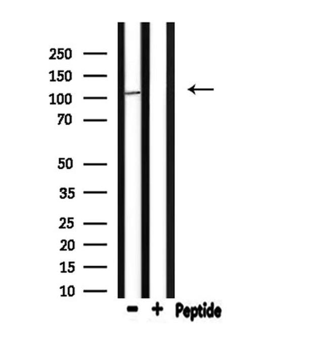 GTF3C3 Antibody in Western Blot (WB)