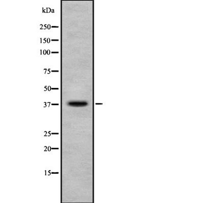 Phospho-Ephrin B1/B2/B3 (Tyr324) Antibody in Western Blot (WB)