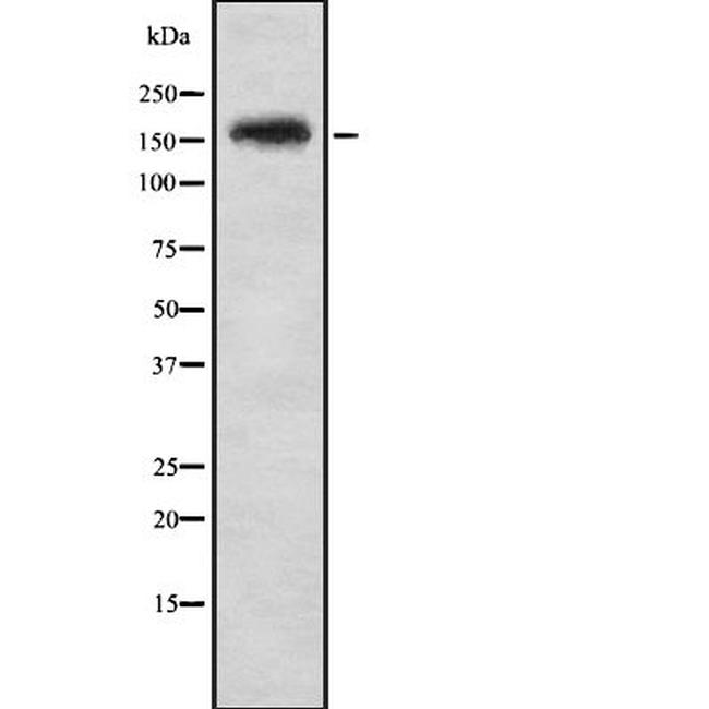 Phospho-FANCA (Ser1149) Antibody in Western Blot (WB)