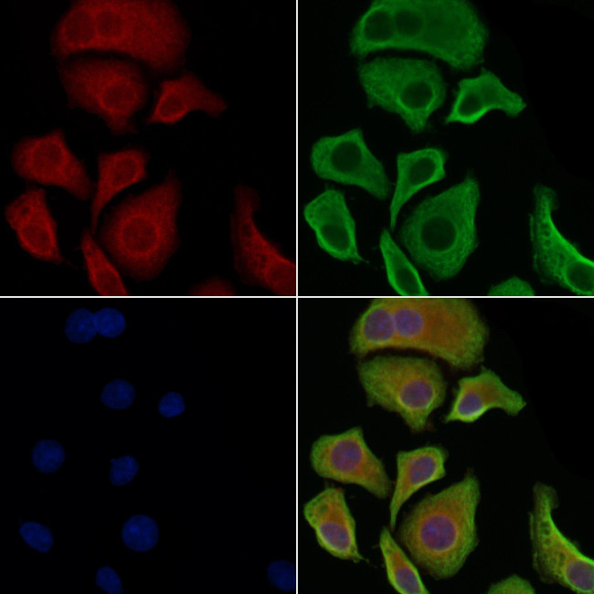 Phospho-MEKK1 (Thr1400) Antibody in Immunocytochemistry (ICC/IF)