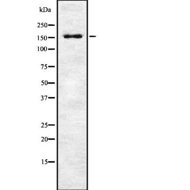 Phospho-MEKK1 (Thr1400) Antibody in Western Blot (WB)