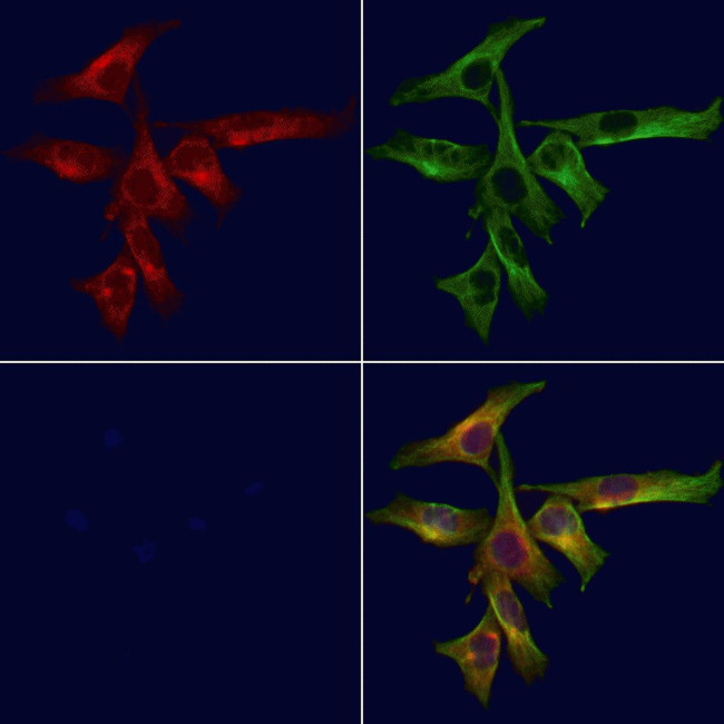 Dystrophin Antibody in Immunocytochemistry (ICC/IF)