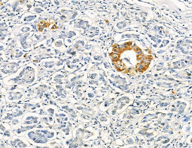 DYRK3 Antibody in Immunohistochemistry (Paraffin) (IHC (P))