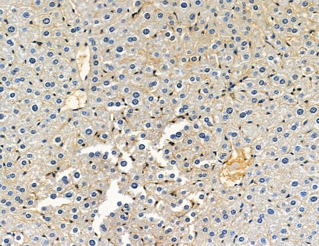 DYRK3 Antibody in Immunohistochemistry (Paraffin) (IHC (P))