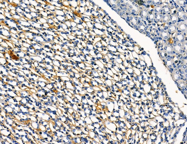 DYRK3 Antibody in Immunohistochemistry (Paraffin) (IHC (P))