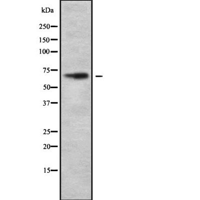 DYRK3 Antibody in Western Blot (WB)