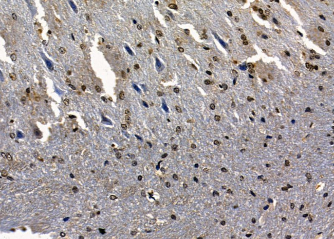 SAP30 Antibody in Immunohistochemistry (Paraffin) (IHC (P))