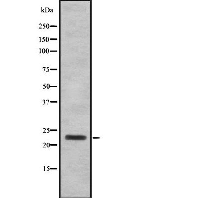 SAP30 Antibody in Western Blot (WB)