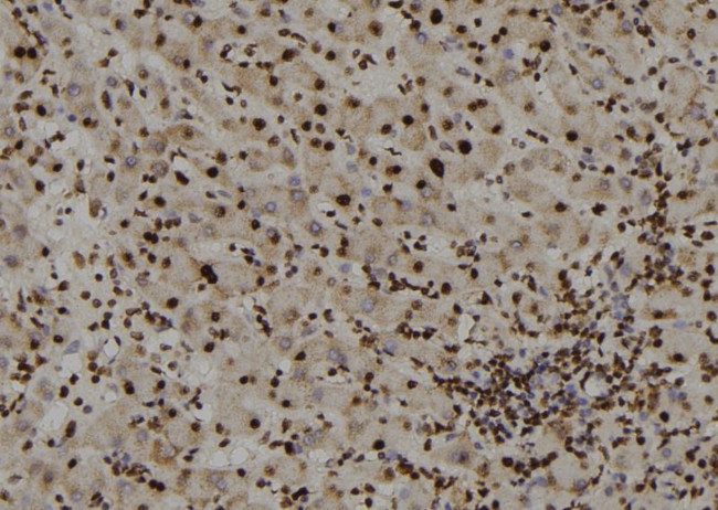 ZIC Pan Antibody in Immunohistochemistry (Paraffin) (IHC (P))