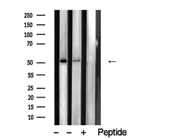 ZIC Pan Antibody in Western Blot (WB)