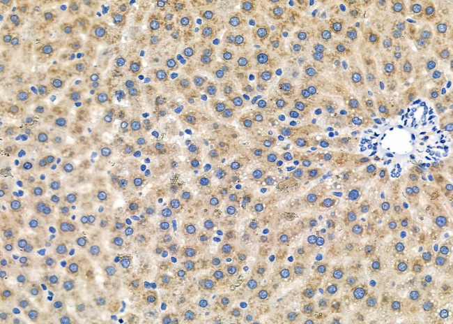 Herpes Simplex Virus Type 1 (strain 17) Antibody in Immunohistochemistry (Paraffin) (IHC (P))