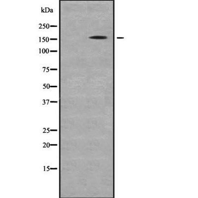 GLI3 Antibody in Western Blot (WB)