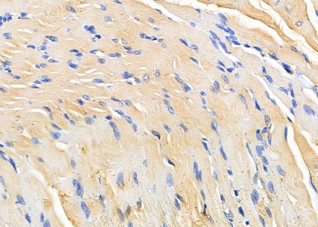 PPP2R1A Antibody in Immunohistochemistry (Paraffin) (IHC (P))