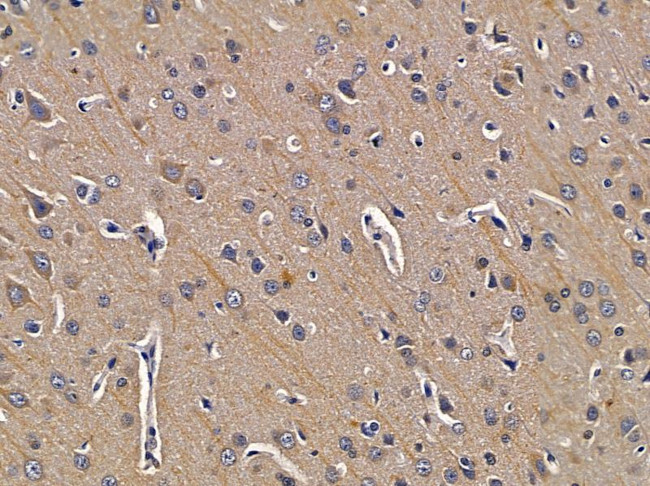 MAPK4 Antibody in Immunohistochemistry (Paraffin) (IHC (P))