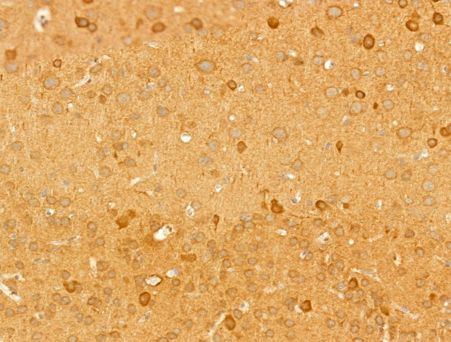 MARCKSL1 Antibody in Immunohistochemistry (Paraffin) (IHC (P))