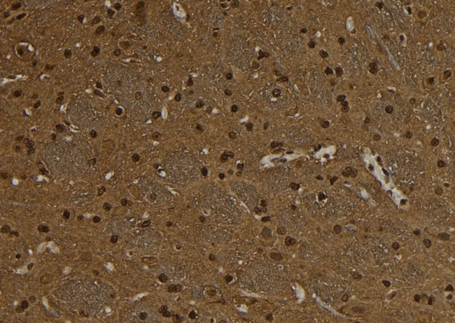 SNRPD3 Antibody in Immunohistochemistry (Paraffin) (IHC (P))