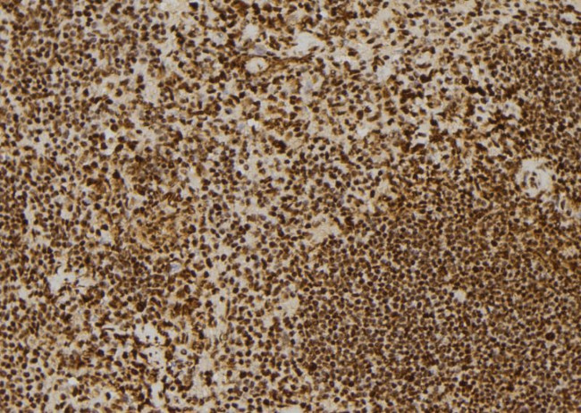 CSB Antibody in Immunohistochemistry (Paraffin) (IHC (P))