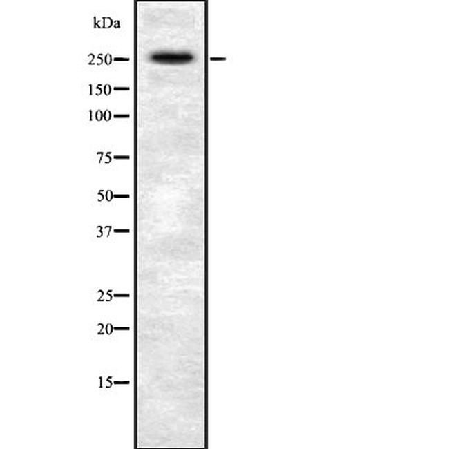 AKAP6 Antibody in Western Blot (WB)