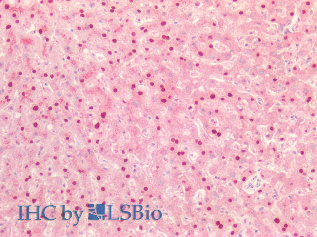 TTF1 Antibody in Immunohistochemistry (Paraffin) (IHC (P))