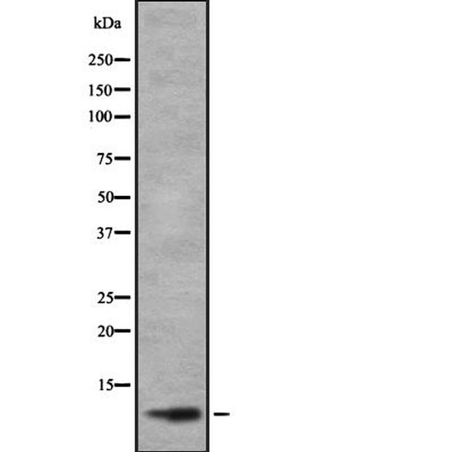 TAL2 Antibody in Western Blot (WB)