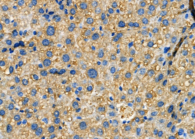 MAP3K15 Antibody in Immunohistochemistry (Paraffin) (IHC (P))