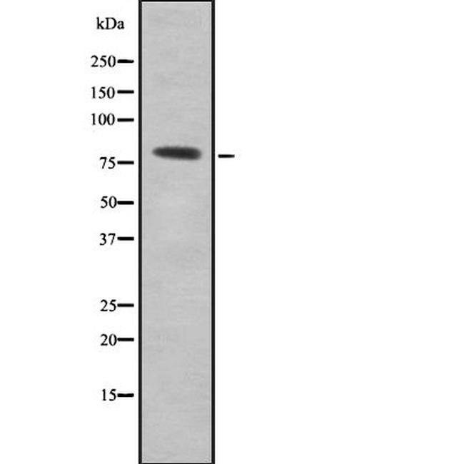 SDCCAG8 Antibody in Western Blot (WB)