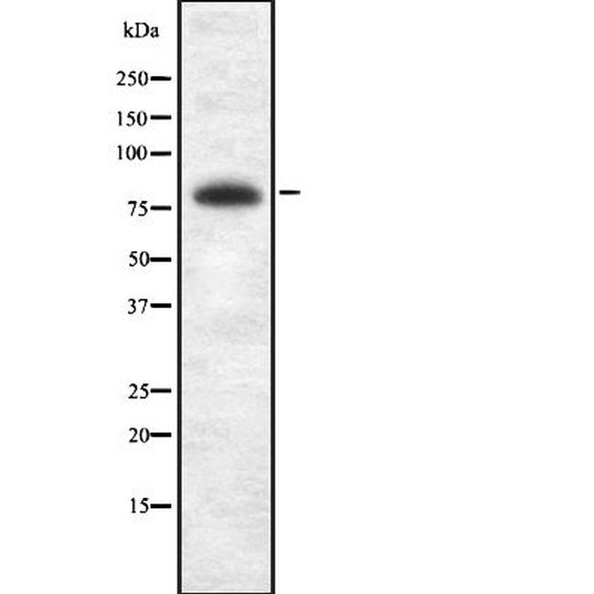 BRSK2 Antibody in Western Blot (WB)