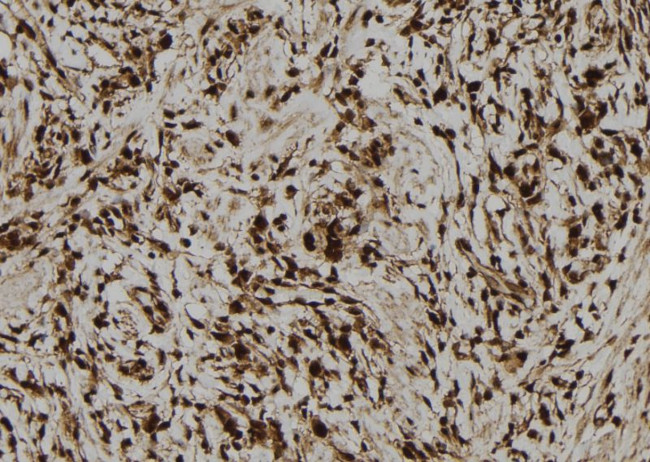 LMO7 Antibody in Immunohistochemistry (Paraffin) (IHC (P))