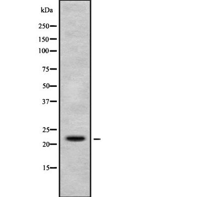 H1FX Antibody in Western Blot (WB)