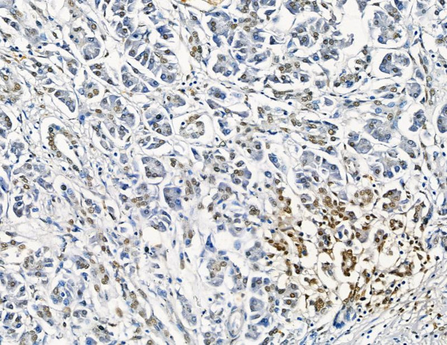 GTF2H4 Antibody in Immunohistochemistry (Paraffin) (IHC (P))